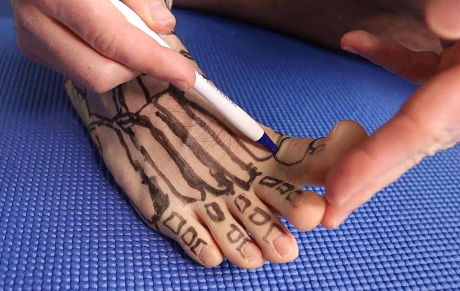 BEST Metatarsalgia Exercises, Massage & Stretches [HOME Treatment]